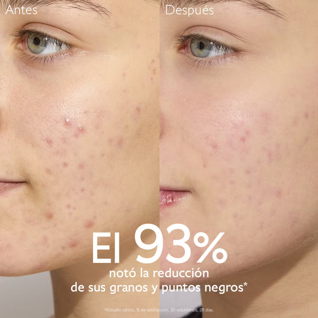 -Sérum-Caudalie-Caudalie,Crema de día,crema de noche,crema matificante,gel anti imperfecciones,piel adulta,Piel con Acné,piel grasa,piel joven,Vinopure-Farmacia Cruz Cubierta