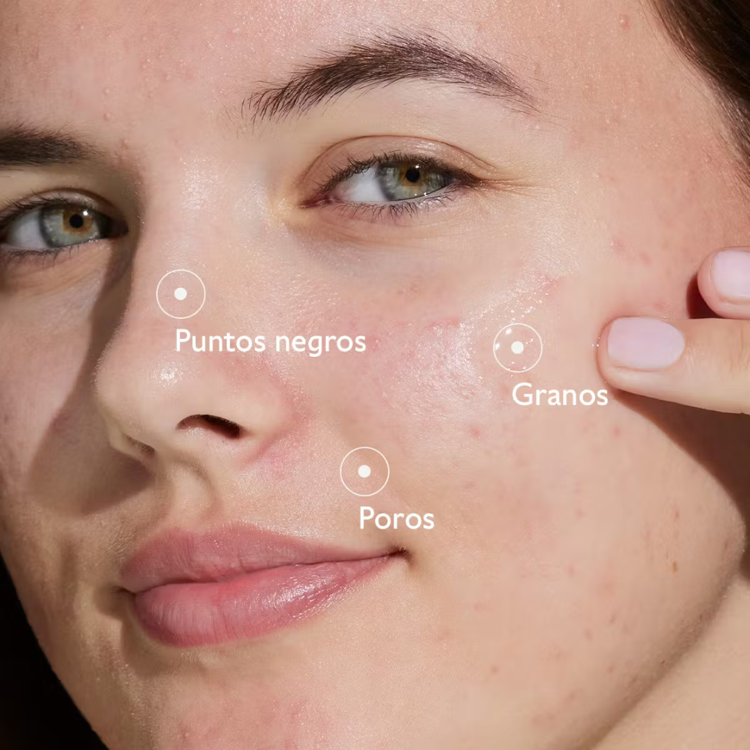 -Sérum-Caudalie-Caudalie,gel anti imperfecciones,piel adulta,Piel con Acné,piel grasa,piel joven,Sérum,Vinopure-Farmacia Cruz Cubierta