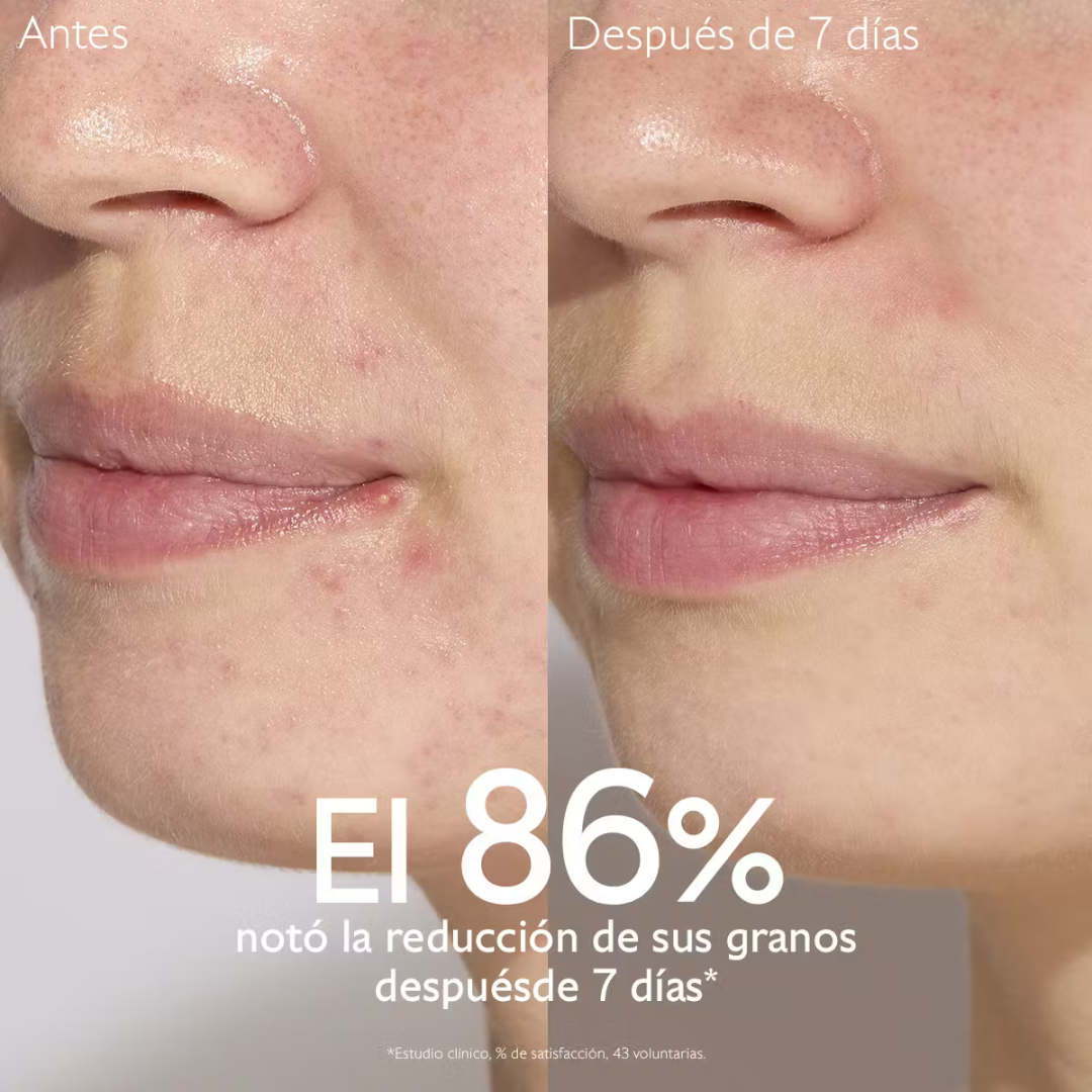 -Sérum-Caudalie-Caudalie,gel anti imperfecciones,piel adulta,Piel con Acné,piel grasa,piel joven,Sérum,Vinopure-Farmacia Cruz Cubierta