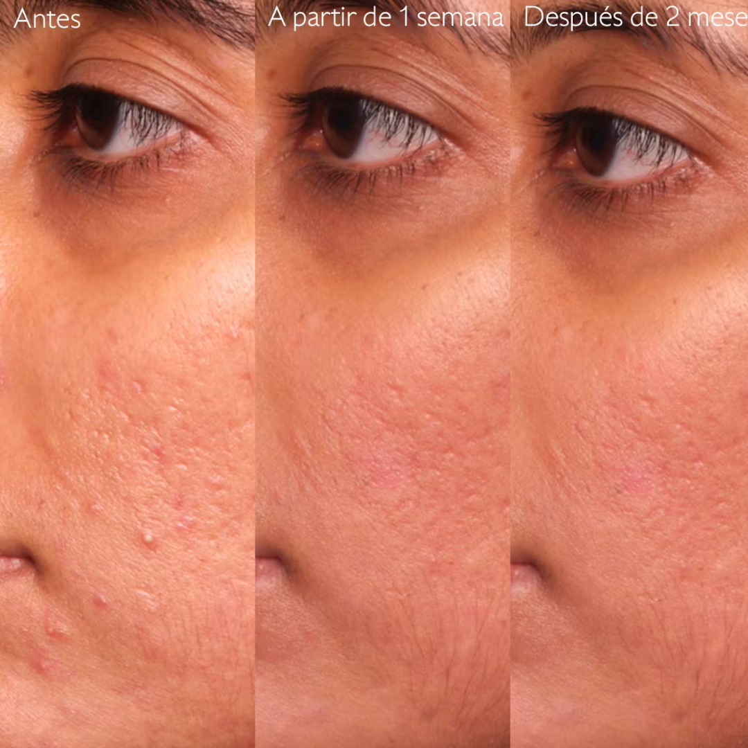 -Sérum-Caudalie-Caudalie,gel anti imperfecciones,piel adulta,Piel con Acné,piel grasa,piel joven,Sérum,Vinopure-Farmacia Cruz Cubierta
