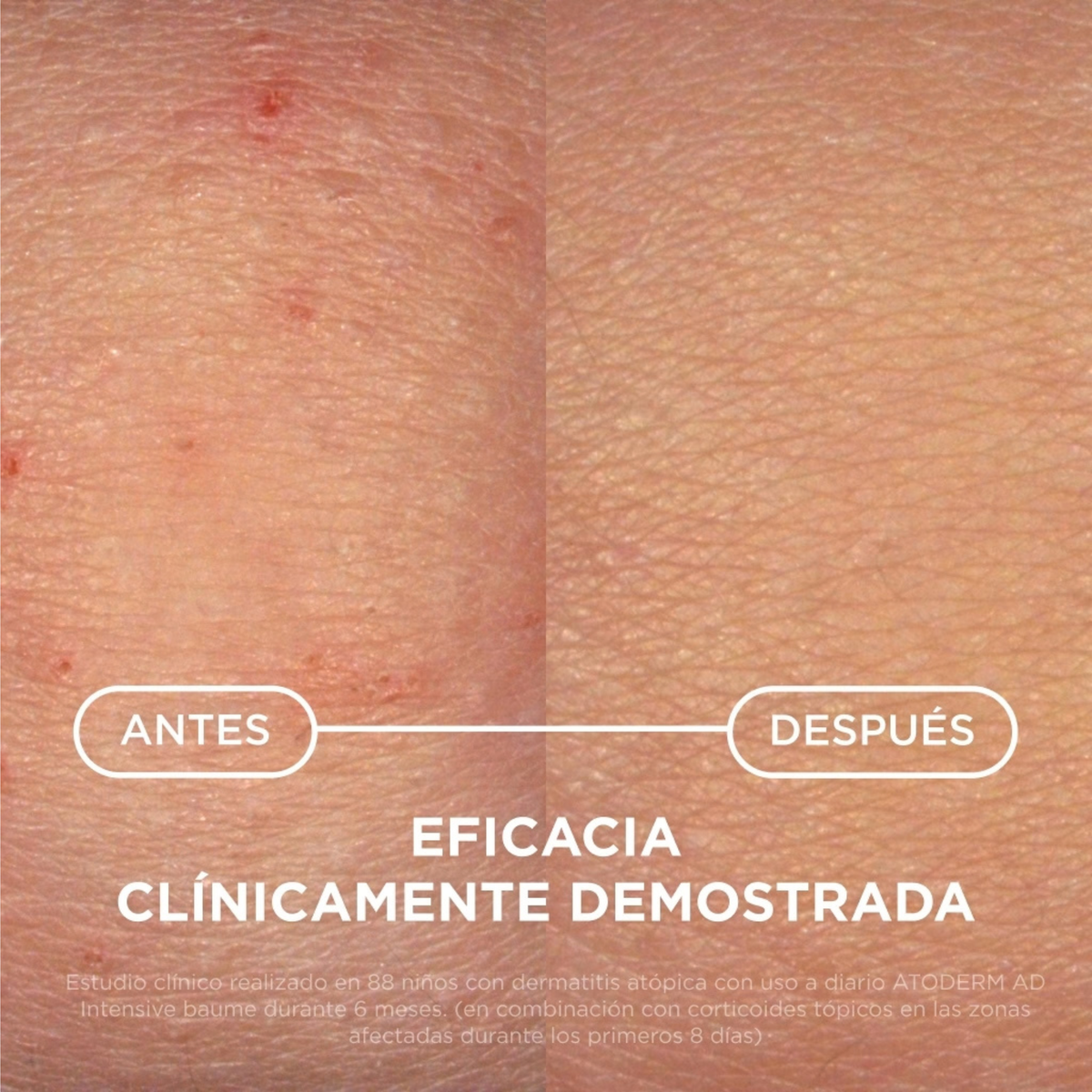 -Bioderma-Bioderma,Bioderma Atoderm,hidratante corporal,piel atópica-Farmacia Cruz Cubierta