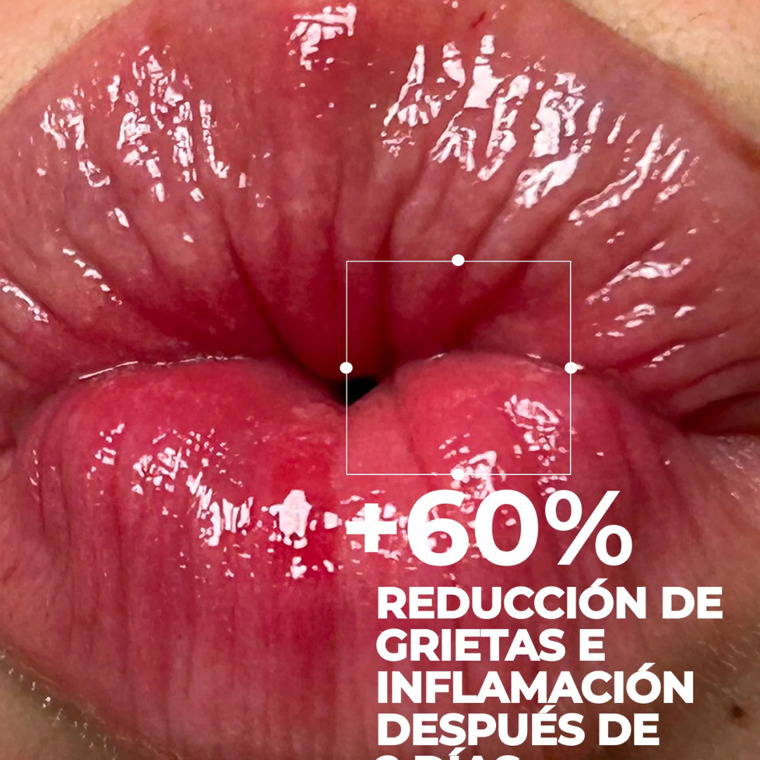-Protector Labial-Segle-hidratante corporal,Protector Labial,Segle-Farmacia Cruz Cubierta