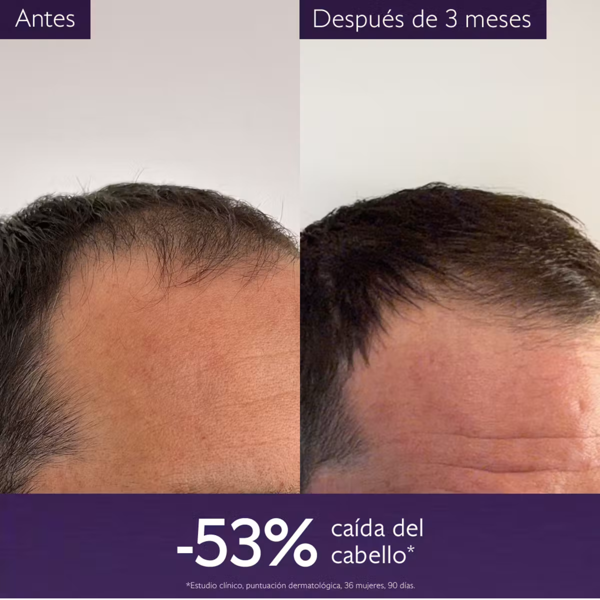 CAUDALIE SERUM CAPILAR ANTICAIDA 50ML