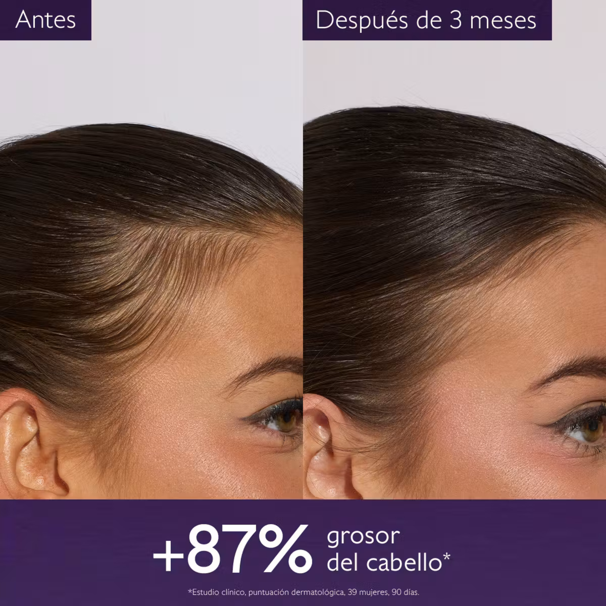 CAUDALIE SERUM CAPILAR ANTICAIDA 50ML