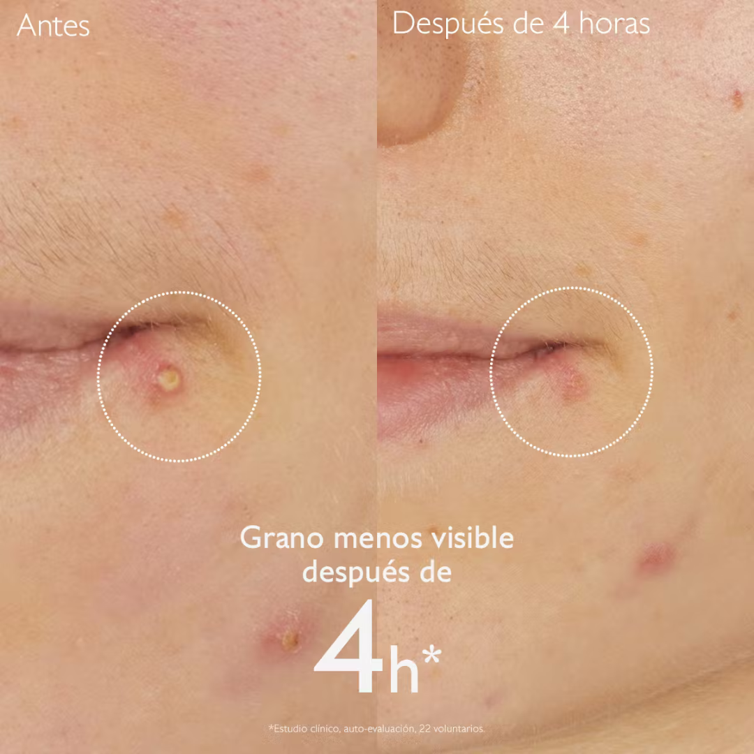 -Caudalie-Caudalie,Piel con Acné-Farmacia Cruz Cubierta